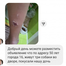 50 лет Города, 16 , собаки покусали ребенка, будьте осторожны